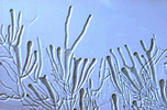 Two-spored tuning fork basidia of the jelly fungus Dacrymyces