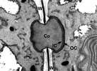 Electron micrograph of a Cumagloia andersonii pit plug