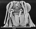 SEM of male head